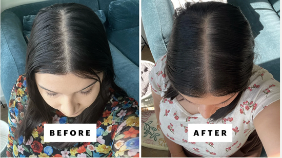 Healthier Hair Starts At The Source